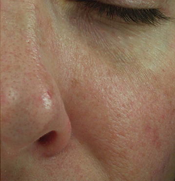 Knoxville Institute of Dermatology