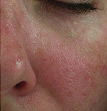 Knoxville Institute of Dermatology