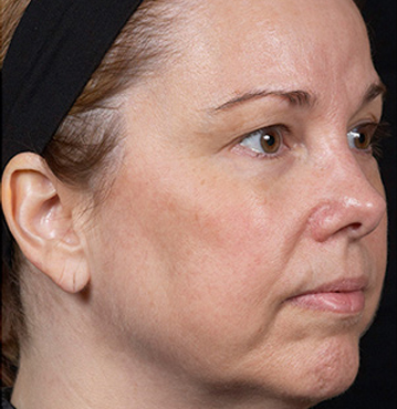 Knoxville Institute of Dermatology