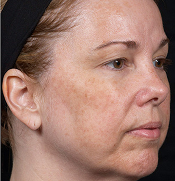 Knoxville Institute of Dermatology