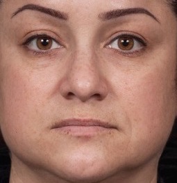 Knoxville Institute of Dermatology