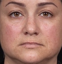 Knoxville Institute of Dermatology